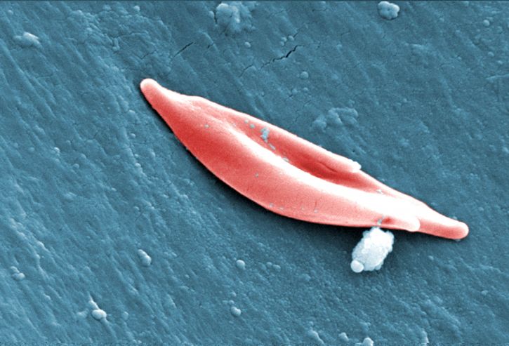 Prodigy: el hombre de los glóbulos rojos&nbsp;menguantes